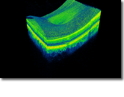 3D OCT Digital Retinal Scans And Photography | Molsom Opticians